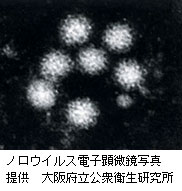 ノロウイルス電子顕微鏡写真（大阪府公衆衛生研究所提供）