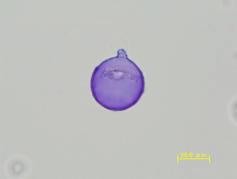 スギ花粉の光学顕微鏡写真像（ゲンチアナバイオレットグリセリンゼリー染色）