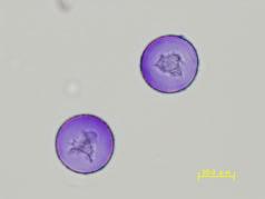 ヒノキ花粉の光学顕微鏡写真像（ゲンチアナバイオレットグリセリンゼリー染色）