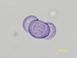 マツ花粉の光学顕微鏡写真像（ゲンチアナバイオレットグリセリンゼリー染色）