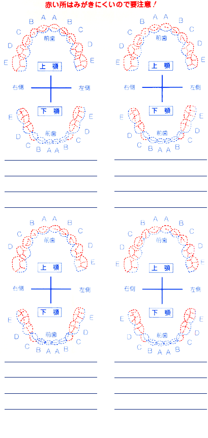歯の検査の記録表の画像