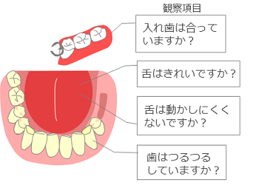 お口の中の観察項目についてのイラスト