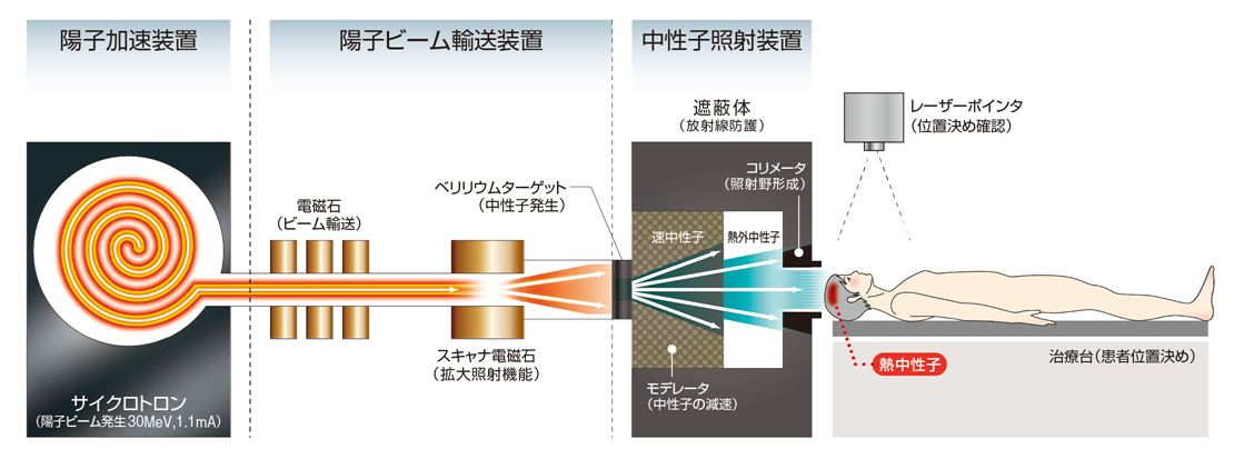 中性子照射イメージ
